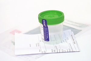urine specimen container
